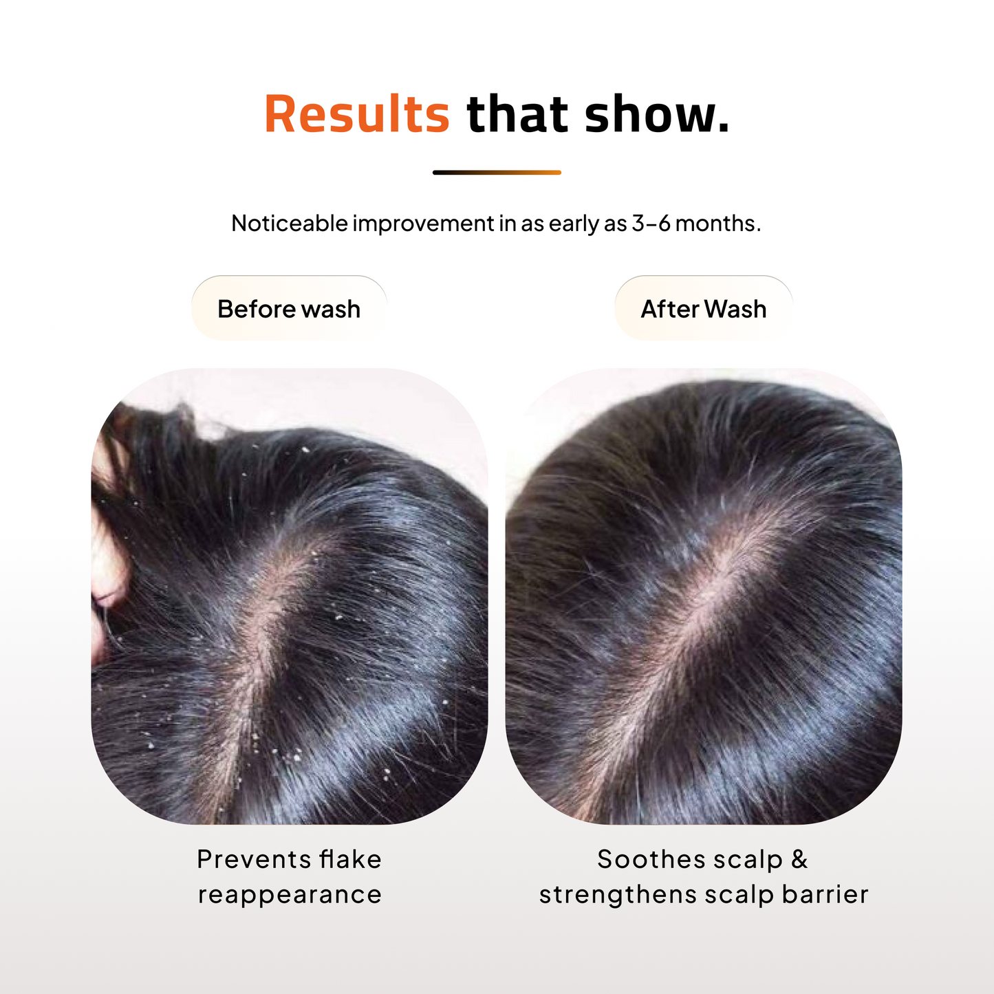 Advance Anti-Hair Fall Shampoo & Conditioner | Keratin | Vitamin E