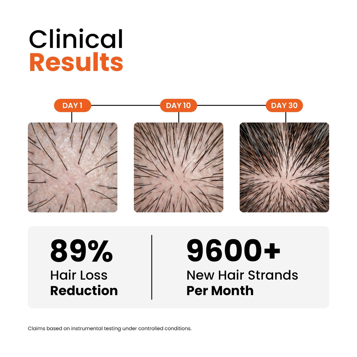 Hair Regrowth Solution Kit | Peraben Free | No Artificial Dyes