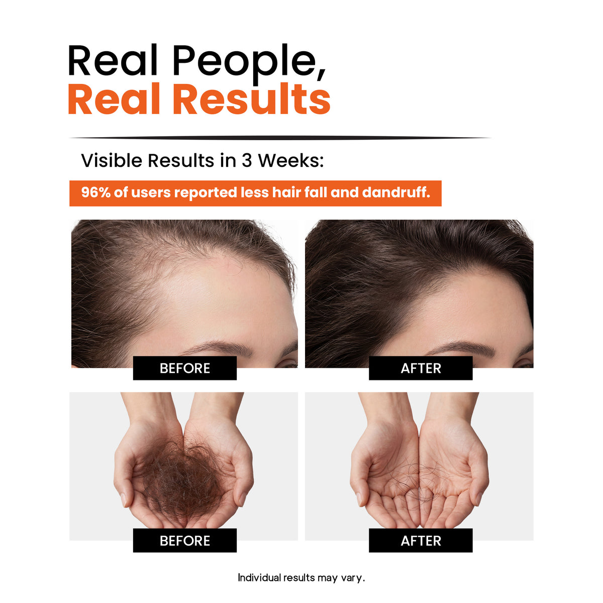Advanced Daily Use Anti-Hair Fall Shampoo | Paraben Free | No Artificial Dyes