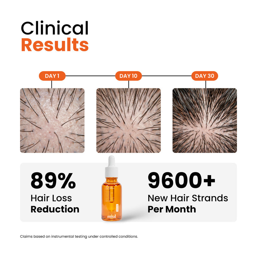 Advance Anti-Hair Fall Shampoo and Growth Serum