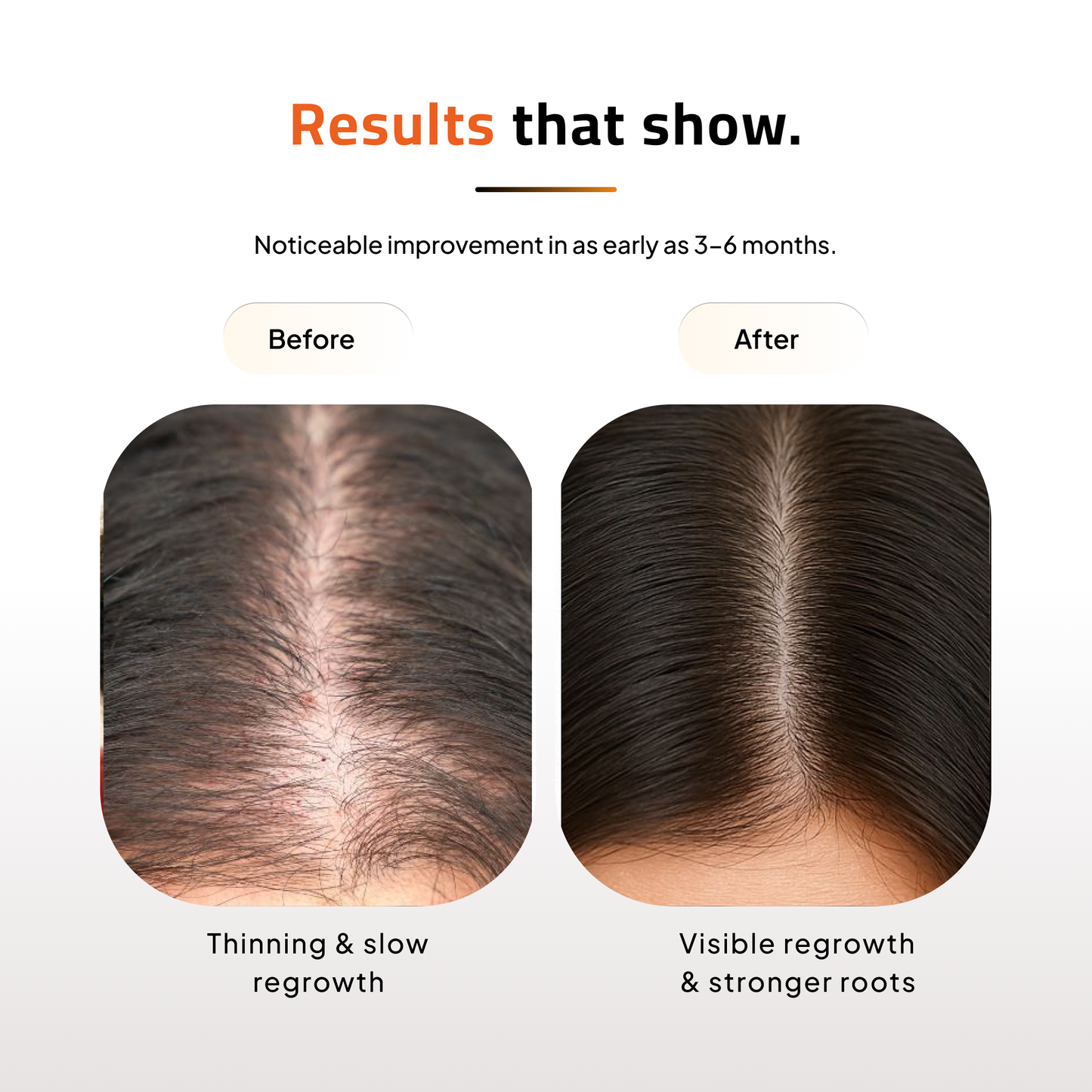 Hair Regrowth Solution Kit | Paraben Free | No Artificial Dyes