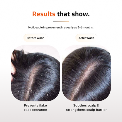 Advance Anti-Hair Fall Shampoo & Conditioner | Keratin | Vitamin E