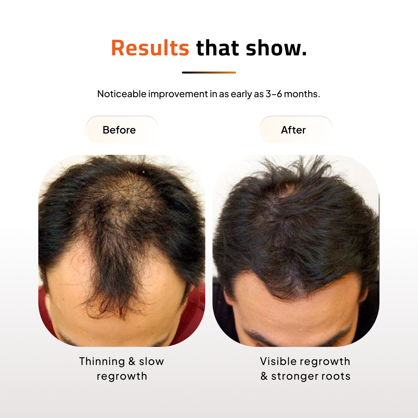 Hair Growth Topical Solution | Scientifically Tested | 60ml