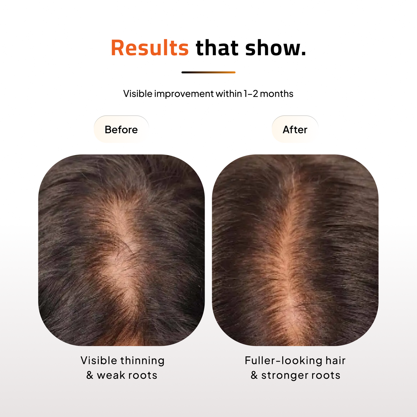 Advanced Hair Growth Serum and Vitamin Supplements | Clinically Tested | Vegan