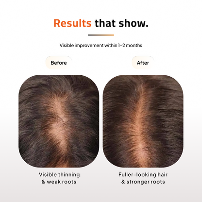 Advanced Hair Growth Serum and Vitamin Supplements | Clinically Tested | Vegan