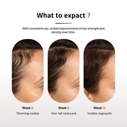 Advanced Daily Use Anti-Hair Fall Shampoo | Paraben Free | No Artificial Dyes