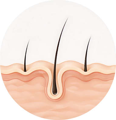 Scalp Activation Begins
