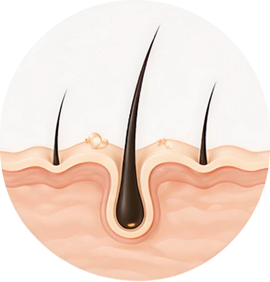 Hair Fall Control