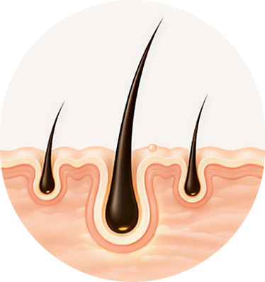 Hair Regrowth